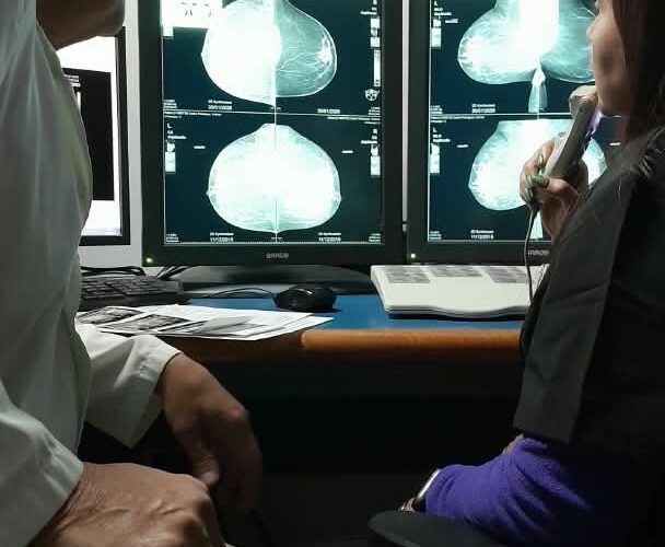 Especialistas en Mastología destacan que el diagnóstico temprano marca la diferencia entre un hallazgo precoz y una lesión avanzada de Cáncer de mama